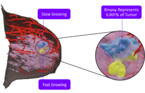SimBioSys – Redefine precision medicine